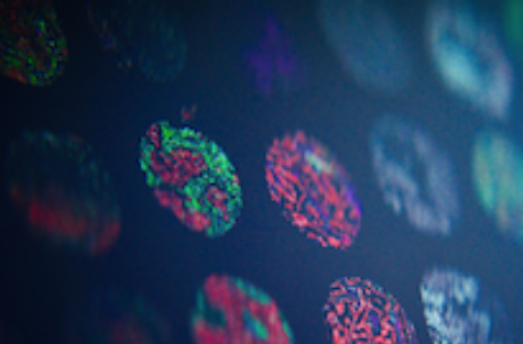 GSK Licenses Noetik’s OCTO Virtual Cell Foundation Models in $50M Partnership to Advance Cancer R&D